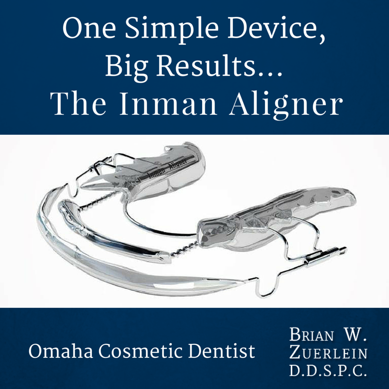 Inman Aligner For Tooth Alignment - Zuerlein Dental - Omaha Cosmetic Dentist