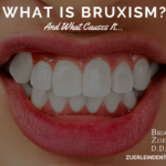 Bruxism, Teeth Grinding – Omaha Cosmetic Dentist – Dr. Jared Bolding