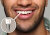 Implant Dentistry in Omaha - Dr. Bolding Dentistry - Omaha Dentist