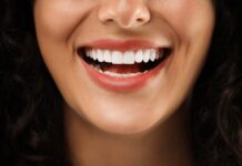 when to get veneers in Omaha, Nebraska