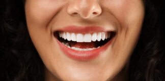 when to get veneers in Omaha, Nebraska